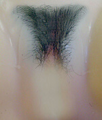 images, pubic hair implant